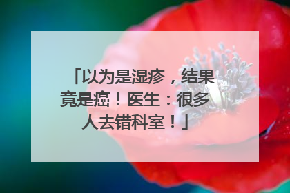 以为是湿疹，结果竟是癌！医生：很多人去错科室！